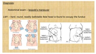Diagnosis:
1. Abdominal exam – leopold’s maneuver
LM1 – hard, round, readily ballotable fetal head is found to occupy the fundus
 