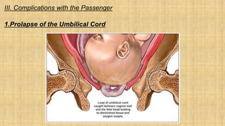 III. Complications with the Passenger
1.Prolapse of the Umbilical Cord
 