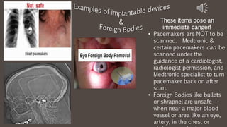 These items pose an
immediate danger!
• Pacemakers are NOT to be
scanned. Medtronic &
certain pacemakers can be
scanned under the
guidance of a cardiologist,
radiologist permission, and
Medtronic specialist to turn
pacemaker back on after
scan.
• Foreign Bodies like bullets
or shrapnel are unsafe
when near a major blood
vessel or area like an eye,
artery, in the chest or
 