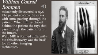 William Conrad
Rontgen
mistakenly discovered x-rays.
The patient absorbs the x-rays
with some passing through the
patient. When film is placed
behind the patient the rays that
pass through the patient form
the image.
Well, MRI is formed differently,
but this discovery was the basis
for all other imaging
techniques.
 
