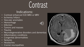 Indications:
• Contrast enhanced (CE) MRA or MRV
• Ischemia/infarct
• Vascular anomalies
• Hemorrhage
• Infection
• Tumors and masses
• Trauma
• Neurodegenerative disorders and dementias
• Inflammatory conditions
• Congenital abnormalities
• Seizures
• Headaches
• Cranial neuropathies
 