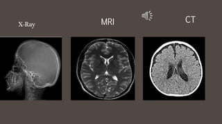 X-Ray
CTMRI
 