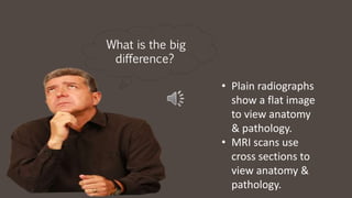 • Plain radiographs
show a flat image
to view anatomy
& pathology.
• MRI scans use
cross sections to
view anatomy &
pathology.
What is the big
difference?
 