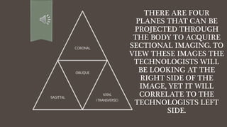 THERE ARE FOUR
PLANES THAT CAN BE
PROJECTED THROUGH
THE BODY TO ACQUIRE
SECTIONAL IMAGING. TO
VIEW THESE IMAGES THE
TECHNOLOGISTS WILL
BE LOOKING AT THE
RIGHT SIDE OF THE
IMAGE, YET IT WILL
CORRELATE TO THE
TECHNOLOGISTS LEFT
SIDE.
CORONAL
SAGITTAL
OBLIQUE
AXIAL
(TRANSVERSE)
 