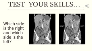 TEST YOUR SKILLS…
Which side
is the right
and which
side is the
left?
LEFTRIGHT
 