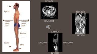 ANTERIOR
ANTERIOR
POSTERIOR
POSTERIOR
SUPERIOR
SUPERIOR
INFERIOR
INFERIOR
 