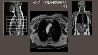 AXIAL/TRANSVERSE
 