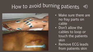 • Make sure there are
no fray parts on
cable
• Don’t allow the
cables to loop or
touch the patients
skin
• Remove ECG leads
from patients skin
 