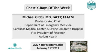 Chest X-Rays Of The Week
Michael Gibbs, MD, FACEP, FAAEM
Professor And Chair
Department of Emergency Medicine
Carolinas Medical Center & Levine Children’s Hospital
Vice President of Research
Atrium Health
CMC X-Ray Mastery Series
February 11th 2019
 