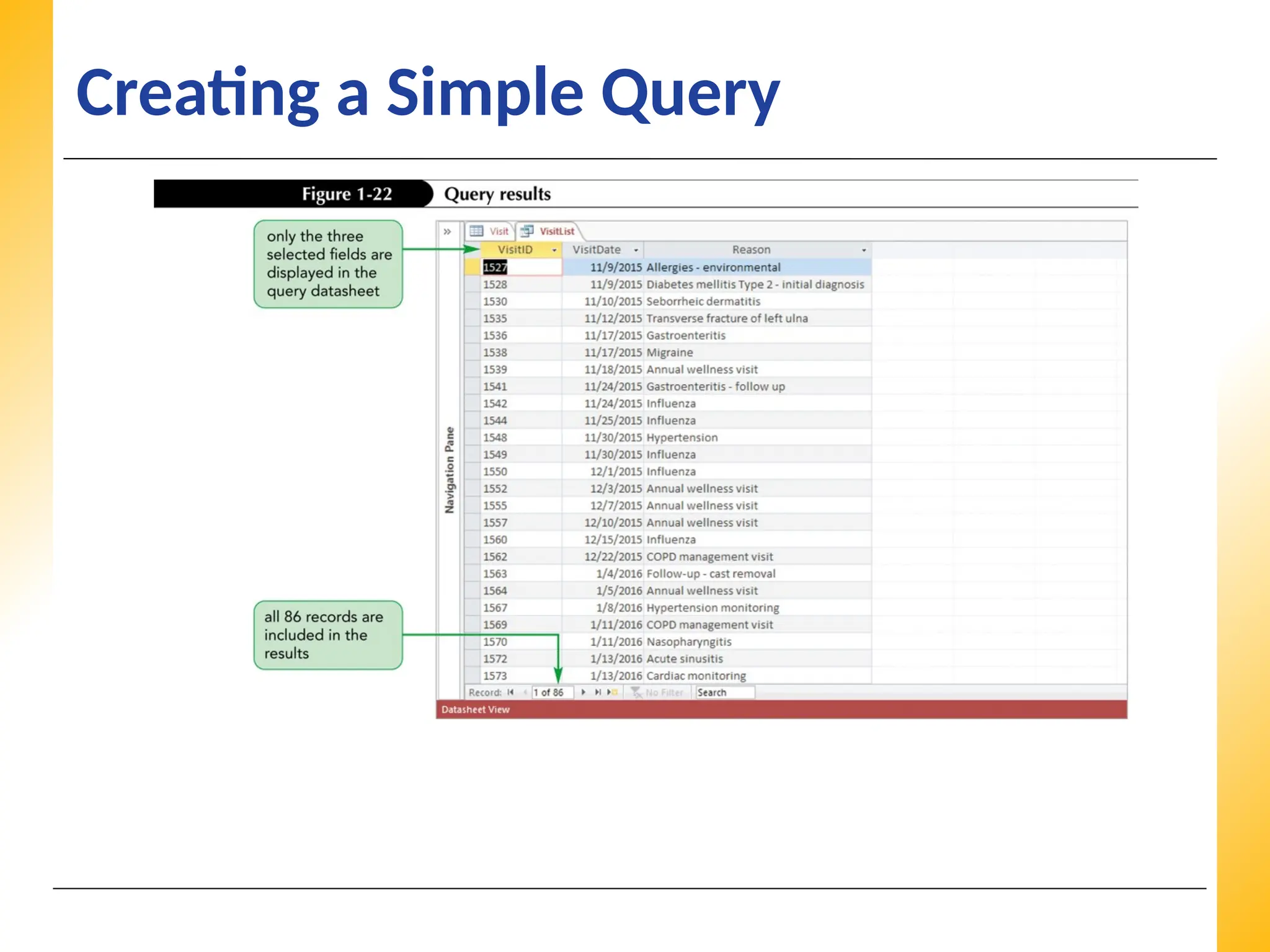 XP
XP
XP
Creating a Simple Query
 