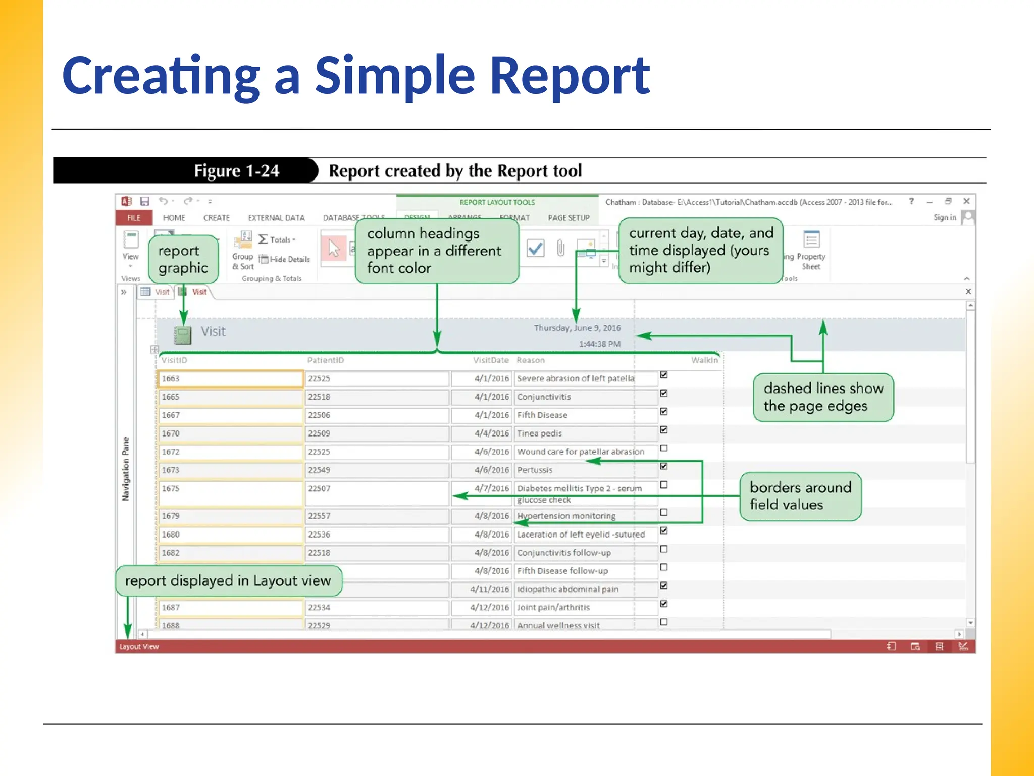 XP
XP
XP
Creating a Simple Report
 