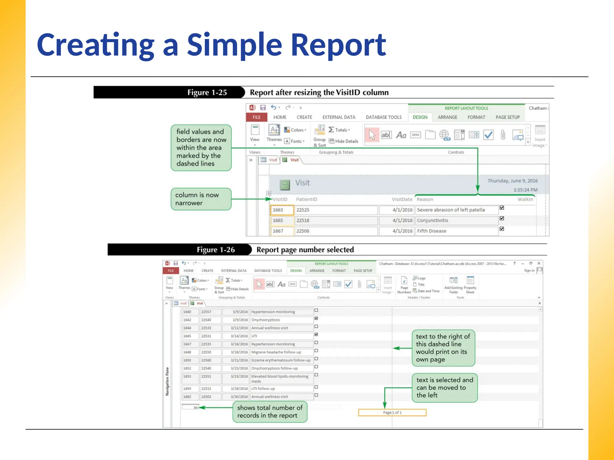 XP
XP
XP
Creating a Simple Report
 