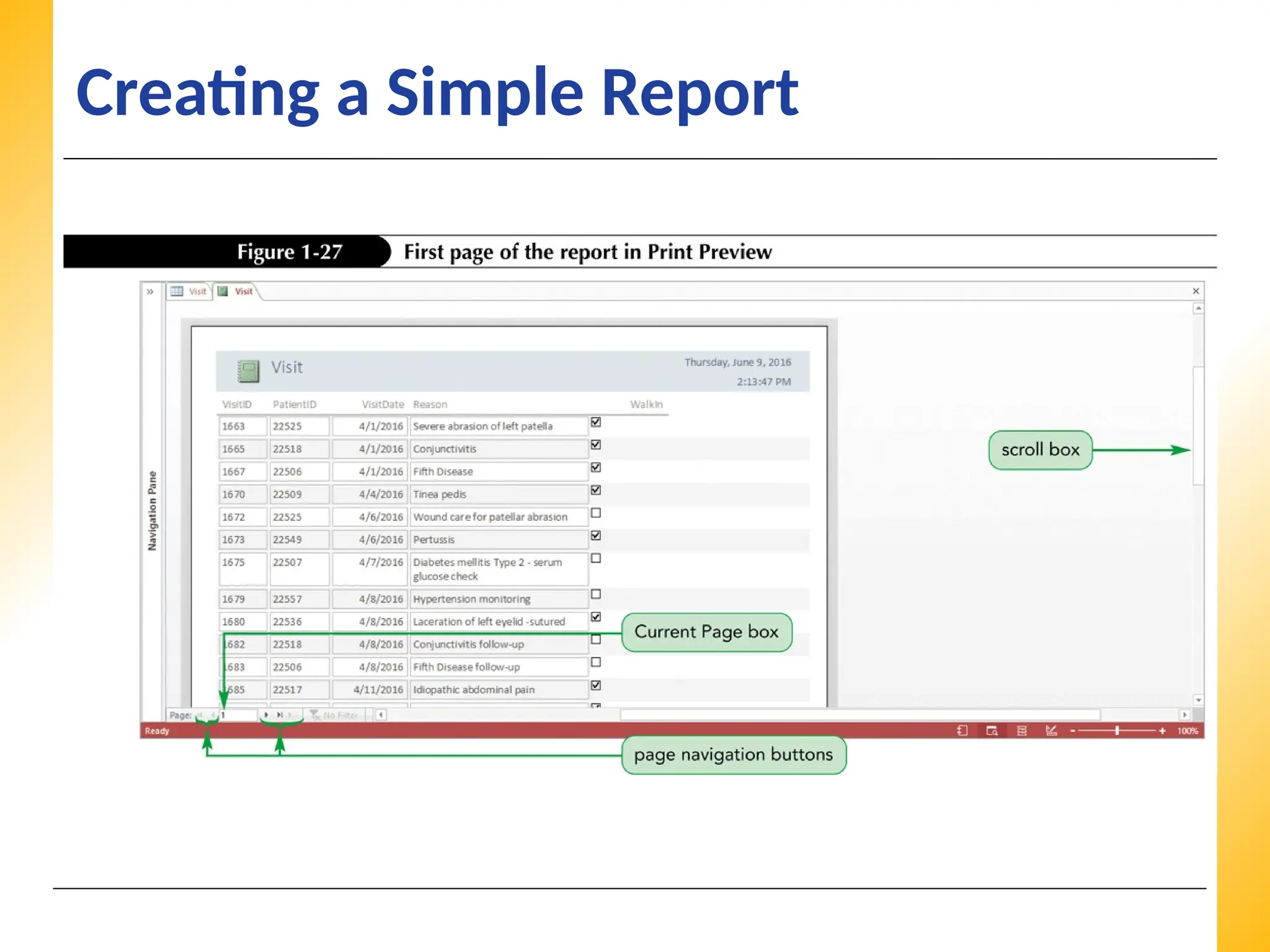 XP
XP
XP
Creating a Simple Report
 