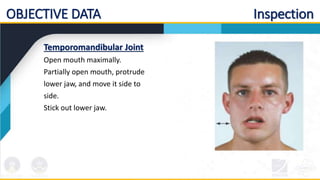 OBJECTIVE DATA Inspection
Temporomandibular Joint
Open mouth maximally.
Partially open mouth, protrude
lower jaw, and move it side to
side.
Stick out lower jaw.
 