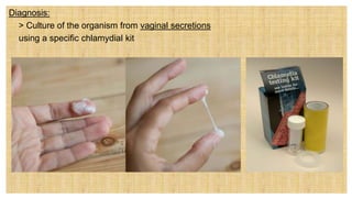 Diagnosis:
 > Culture of the organism from vaginal secretions
 using a specific chlamydial kit
 