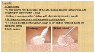 Example:
• 1.Cryocautery
 >At first, edema may be present at the site, lesions become gangrenous, and
sloughing off occurs within 7 days
 >Healing is complete within 14 days with slight depigmentation on site
 2.Sitz bath and lidocaine may have some soothing effects
 >If it is not a burden on the woman, it can be left and be removed during the
postpartal period
 3.Knife excision
 