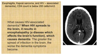 Esophagitis, Kaposi sarcoma, and HIV – associated
dementia), CD4 count is below 200 cells/mm3.
What causes HIV-associated
dementia? When HIV spreads to
the brain, it results in
encephalopathy (a disease which
affects the brain's function), which
causes dementia. The greater the
spread of infection in the brain, the
worse the dementia symptoms
become.
 