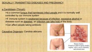 SEXUALLY TRANSMITTED DISEASES AND PREGNANCY
a.Candidiasis (Thrush)
 >Is a common fungus that harmlessly infect people and it is normally well
controlled by our immune system
 >If immune system is weakened because of infection, excessive alcohol or
diseases such as diabetes, an infection can take hold of the body
 >Can affect people taking antibiotic
Causative Organism: Candida albicans
 