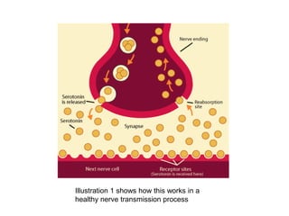 Illustration 1 shows how this works in a
healthy nerve transmission process

 