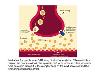Illustration 3 shows how an SSRI drug blocks the reuptake of Serotonin thus
causing the concentration in the synaptic cleft to be increased. Consequently
more serotonin makes it to the receptor sites on the next nerve cell and the
functioning returns to normal.

 
