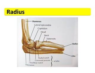 Radius	
  
 