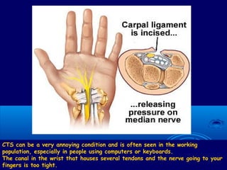 CTS can be a very annoying condition and is often seen in the working
population, especially in people using computers or keyboards.
The canal in the wrist that houses several tendons and the nerve going to your
fingers is too tight.
 