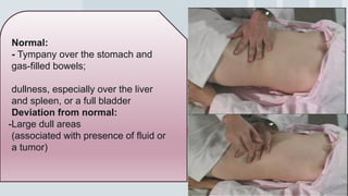 42
Normal:
- Tympany over the stomach and
gas-filled bowels;
dullness, especially over the liver
and spleen, or a full bladder
Deviation from normal:
-Large dull areas
(associated with presence of fluid or
a tumor)
 