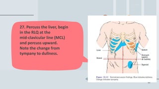 44
27. Percuss the liver, begin
in the RLQ at the
mid-clavicular line (MCL)
and percuss upward.
Note the change from
tympany to dullness.
 