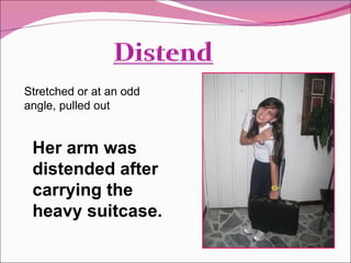 Her arm was distended after carrying the heavy suitcase. Stretched or at an odd angle, pulled out 