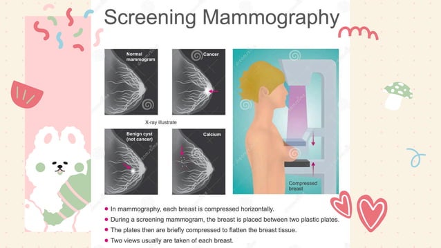 Mammography Positioning Guidebook.pdf Mammography: Breast Anatomy & Imaging Techniques.pdf