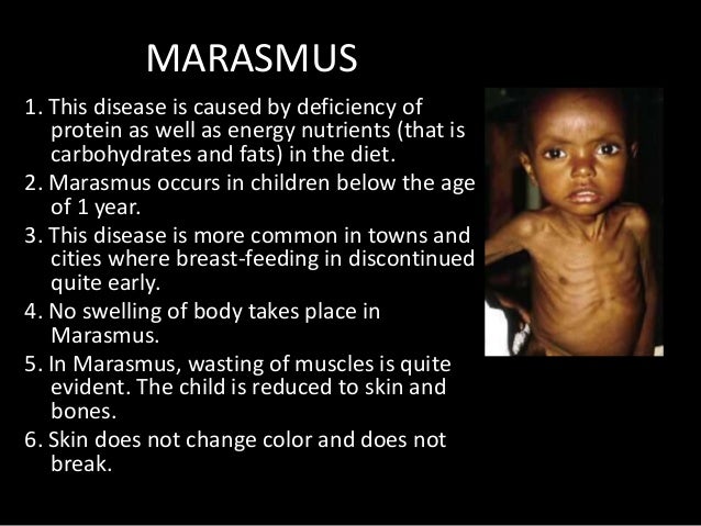 community and public health week 2 3 protein energy malnutrition