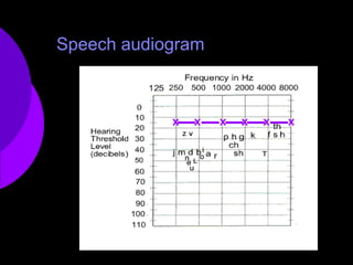 Sound Octogram Speech acoustics | PPTX