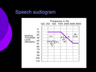 Speech audiogram