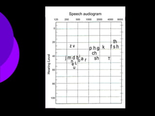 Speech audiogram