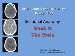 Bellingham Technical College
        Biology 130

 Sectional Anatomy
     Week 3:
    The Brain


           Instructor: Ken Wilkerson
           E-mail: wilkersk@hotmail.com
 