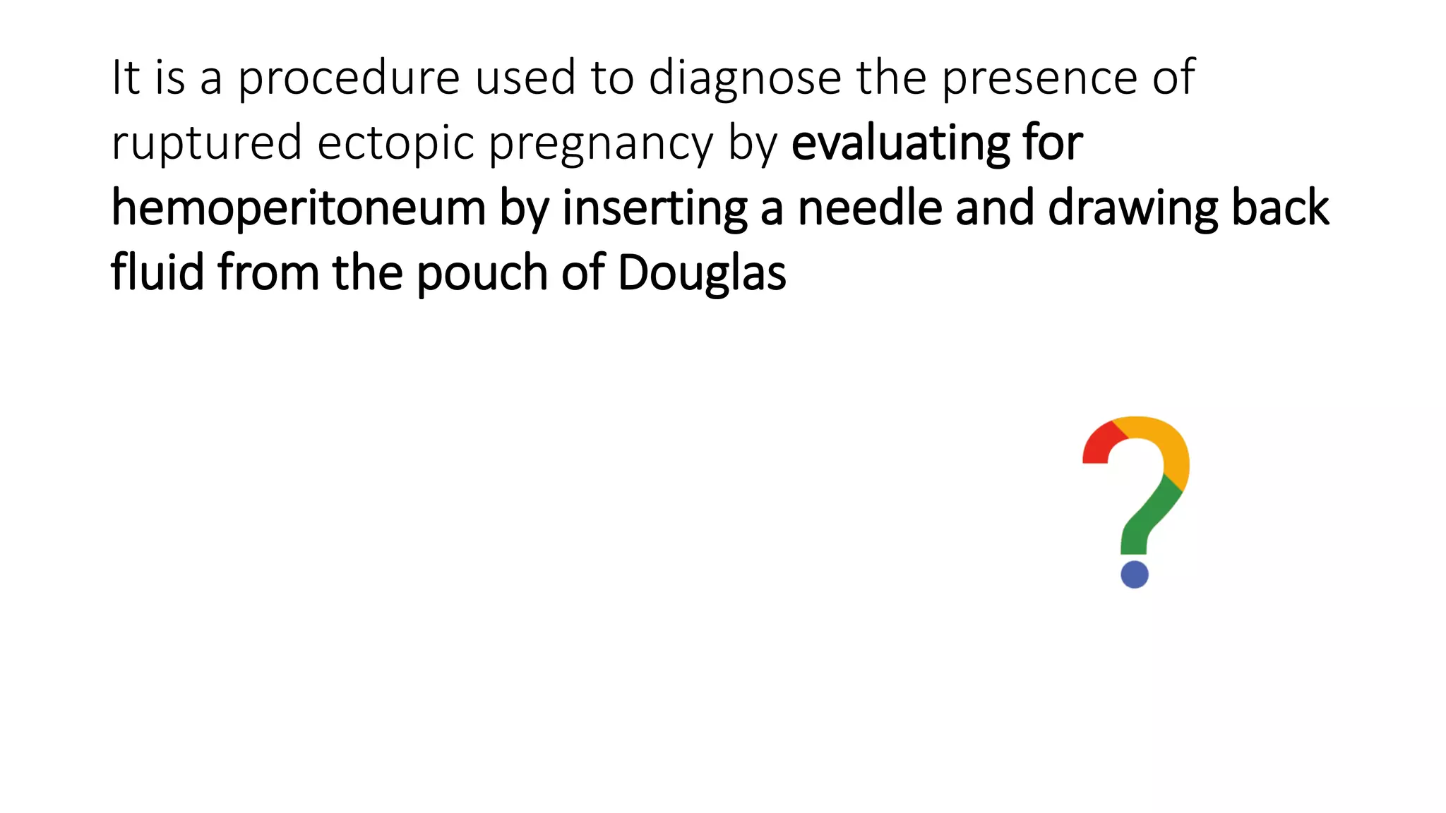 It is a procedure used to diagnose the presence of
ruptured ectopic pregnancy by evaluating for
hemoperitoneum by inserting a needle and drawing back
fluid from the pouch of Douglas
 