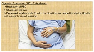 Signs and Symptoms of HELLP Syndrome:
 > Breakdown of RBC
 > Changes in the liver
 > Decreased platelets (cells found in the blood that are needed to help the blood to
clot in order to control bleeding)
 