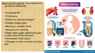 Signs and Symptoms: may experience
symptoms differently:
 >Increased BP
 >Proteinuria
 >Edema on face and fingers
 >Sudden weight gain
 >Blurring or double vision
 >Nausea and vomiting
 >Right sided upper abdominal pain
or pain around the stomach
 >Decreased urine output
 >Changes in liver or kidney function
test
 
