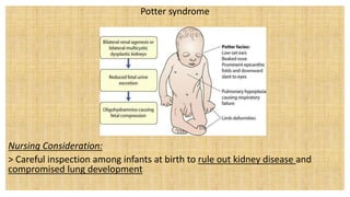 Potter syndrome
Nursing Consideration:
> Careful inspection among infants at birth to rule out kidney disease and
compromised lung development
 