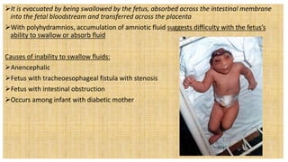 It is evacuated by being swallowed by the fetus, absorbed across the intestinal membrane
into the fetal bloodstream and transferred across the placenta
With polyhydramnios, accumulation of amniotic fluid suggests difficulty with the fetus’s
ability to swallow or absorb fluid
Causes of inability to swallow fluids:
Anencephalic
Fetus with tracheoesophageal fistula with stenosis
Fetus with intestinal obstruction
Occurs among infant with diabetic mother
 