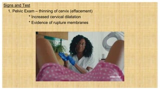 Signs and Test
 1. Pelvic Exam – thinning of cervix (effacement)
* Increased cervical dilatation
* Evidence of rupture membranes
 