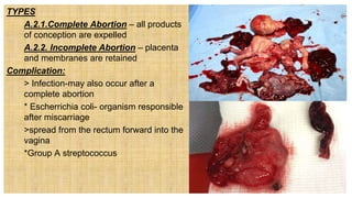 TYPES
1. A.2.1.Complete Abortion – all products
of conception are expelled
2. A.2.2. Incomplete Abortion – placenta
and membranes are retained
Complication:
 > Infection-may also occur after a
complete abortion
 * Escherrichia coli- organism responsible
after miscarriage
 >spread from the rectum forward into the
vagina
 *Group A streptococcus
 