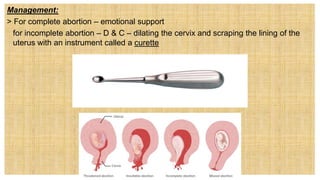 Management:
> For complete abortion – emotional support
for incomplete abortion – D & C – dilating the cervix and scraping the lining of the
uterus with an instrument called a curette
 