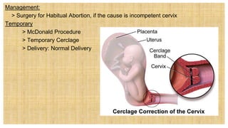 Management:
 > Surgery for Habitual Abortion, if the cause is incompetent cervix
Temporary
> McDonald Procedure
> Temporary Cerclage
> Delivery: Normal Delivery
 