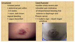 Unruptured Tubal Ruptured
>missed period >sudden sharp severe pain
> abdominal pain within >shoulder pain (indicative
3-5 weeks of intraperitoneal bleeding that
> scant, dark brown extends to diaphragm and
vaginal bleeding Phrenic nerve)
> vague discomfort > + Cullen’s sign – bluish tinged
umbilicus
 