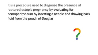 It is a procedure used to diagnose the presence of
ruptured ectopic pregnancy by evaluating for
hemoperitoneum by inserting a needle and drawing back
fluid from the pouch of Douglas
 