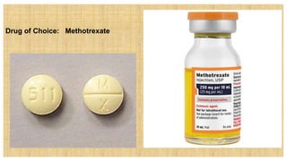 Drug of Choice: Methotrexate
 