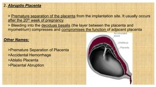 2. Abruptio Placenta
 > Premature separation of the placenta from the implantation site. It usually occurs
after the 20th week of pregnancy
 > Bleeding into the deciduas basalis (the layer between the placenta and
myometrium) compresses and compromises the function of adjacent placenta
Other Names:
 >Premature Separation of Placenta
 >Accidental Hemorrhage
 >Ablatio Placenta
 >Placental Abruption
 