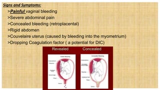 Signs and Symptoms:
 >Painful vaginal bleeding
 >Severe abdominal pain
 >Concealed bleeding (retroplacental)
 >Rigid abdomen
 >Couvelaire uterus (caused by bleeding into the myometrium)
 >Dropping Coagulation factor ( a potential for DIC)
 