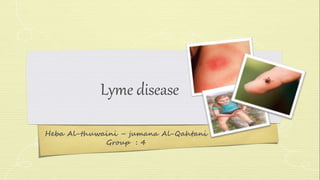 Lyme disease 
Heba Al-thuwaini – jumana Al-Qahtani 
Group : 4 
 